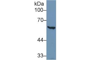 Western Blot; Sample: Human Hela cell lysate; Primary Ab: 1µg/ml Rabbit Anti-Human G6PD Antibody Second Ab: 0. (Glucose-6-Phosphate Dehydrogenase 抗体  (AA 1-515))
