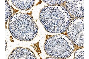 ABIN7095603 and ABIN7099665 at 1/100 staining mouse testis tissue by IHC-P. (ANP32E 抗体)