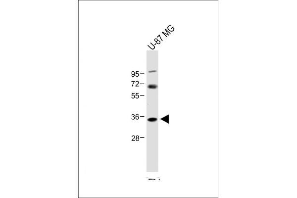 NAT8L 抗体  (AA 59-93)