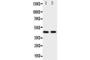 Anti-Flotillin 2 antibody, Western blotting Lane 1: Rat Lung Tissue Lysate Lane 2: 293T Cell Lysate (Flotillin 2 抗体  (N-Term))