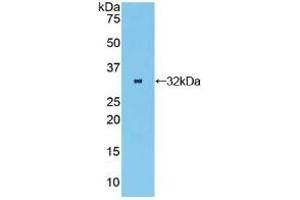 Detection of Recombinant OSMR, Human using Polyclonal Antibody to Oncostatin M Receptor (OSMR) (Oncostatin M Receptor 抗体  (AA 513-760))