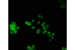 Immunofluorescent analysis of PC-3 cells using ABIN7172771 at dilution of 1:100 and Alexa Fluor 488-congugated AffiniPure Goat Anti-Rabbit IgG(H+L) (ERG 抗体  (AA 1-486))