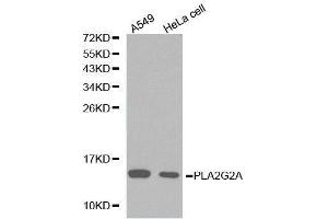 Western Blotting (WB) image for anti-Phospholipase A2, Group IIA (Platelets, Synovial Fluid) (PLA2G2A) (AA 21-144) antibody (ABIN3021802) (PLA2G2A 抗体  (AA 21-144))