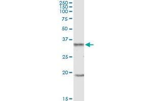 UCP2 MaxPab polyclonal antibody. (UCP2 抗体  (AA 1-309))