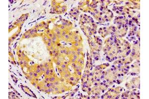 Immunohistochemistry of paraffin-embedded human pancreatic tissue using ABIN7154478 at dilution of 1:100 (GAS1 抗体  (AA 248-318))