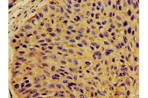 Immunohistochemistry (IHC) image for anti-Colony Stimulating Factor 2 Receptor, Beta (CSF2RB) (AA 492-710) antibody (ABIN7149290)