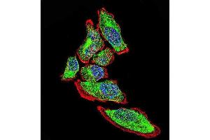 Confocal immunofluorescent analysis of Vimentin Antibody with A549 cell followed by Alexa Fluor 488-conjugated goat anti-rabbit lgG (green). (Vimentin 抗体)