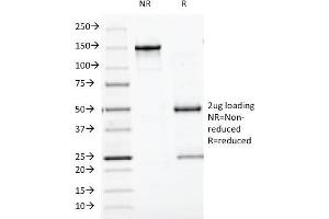 SDS-PAGE Analysis Purified Chromogranin A Monoclonal Antibody (CGA/413). (Chromogranin A 抗体)