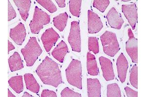 Immunohistochemistry (IHC) image for anti-ATP Synthase, H+ Transporting, Mitochondrial F1 Complex, O Subunit (ATP5O) (AA 38-64) antibody (ABIN1804557)
