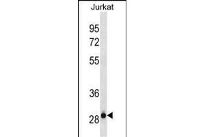 HAGH Antibody (C-term)(Ascites) ABIN1882252 western blot analysis in Jurkat cell line lysates (35 μg/lane). (HAGH 抗体  (C-Term))
