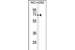 NUMB Antibody (N-term) (ABIN655396 and ABIN2844944) western blot analysis in NCI- cell line lysates (35 μg/lane). (NUMB 抗体  (N-Term))