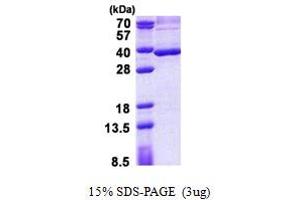 SDS-PAGE (SDS) image for Stanniocalcin 2 (STC2) (AA 25-302) protein (His tag) (ABIN5853017) (Stanniocalcin 2 Protein (STC2) (AA 25-302) (His tag))