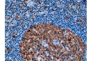 Immunohistochemistry (IHC) image for anti-Stathmin 1 (STMN1) (AA 2-149) antibody (ABIN7435226)