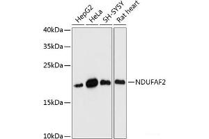Western blot analysis of extracts of various cell lines using NDUFAF2 Polyclonal Antibody at dilution of 1:3000. (NDUFAF2 抗体)