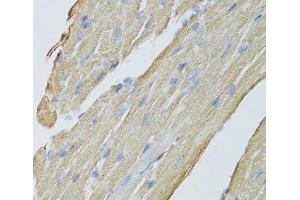 Immunohistochemistry of paraffin-embedded Mouse heart using CKMT2 Polyclonal Antibody at dilution of 1:100 (40x lens). (CKMT2 抗体)