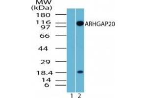 Image no. 3 for anti-rho GTPase Activating Protein 20 (ARHGAP20) (AA 570-620) antibody (ABIN207767) (ARHGAP20 抗体  (AA 570-620))