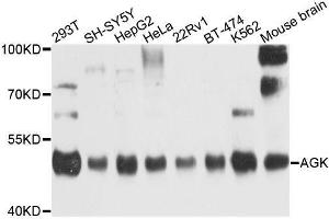 Western blot analysis of extracts of various cell lines, using AGK antibody. (Acylglycerol Kinase 抗体  (AA 233-422))