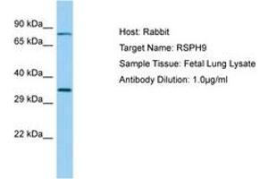 Image no. 1 for anti-Radial Spoke Head 9 Homolog (RSPH9) (AA 99-148) antibody (ABIN6749894) (RSPH9 抗体  (AA 99-148))