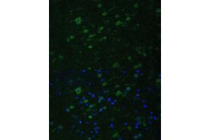 Immunofluorescence analysis of mouse brain using KMT2E antibody (ABIN6131786, ABIN6142983, ABIN6142984 and ABIN6221745) at dilution of 1:100.