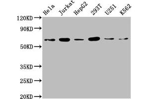 Western Blot Positive WB detected in: Hela whole cell lysate, Jurkat whole cell lysate, HepG2 whole cell lysate, 293T whole cell lysate, U251 whole cell lysate, K562 whole cell lysate All lanes: NUP58 antibody at 1:2000 Secondary Goat polyclonal to rabbit IgG at 1/50000 dilution Predicted band size: 61, 51, 60 kDa Observed band size: 65 kDa (NUPL1 抗体  (AA 211-480))