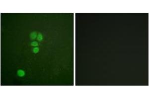 Immunofluorescence analysis of A549 cells, using SOX9 (Ab-181) Antibody. (SOX9 抗体  (AA 147-196))