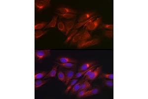 Immunofluorescence analysis of U2OS cells using Raptor Rabbit pAb (ABIN7269901) at dilution of 1:50 (40x lens). (Raptor 抗体)