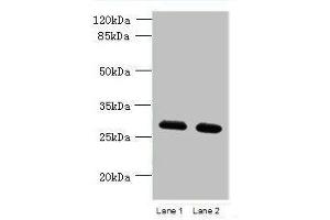 Western blot All lanes: TMEM38B antibody at 1. (TMEM38B 抗体  (AA 249-291))