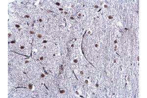IHC-P Image CBX1 / HP1 beta antibody detects CBX1 / HP1 beta protein at nucleus on mouse middle brain by immunohistochemical analysis. (CBX1 抗体  (Center))
