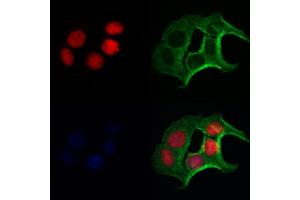 FLCN Antibody staining Hela cells by IF/ICC. (FLCN 抗体  (N-Term))