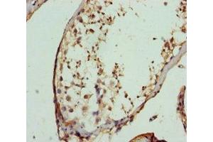 Immunohistochemistry of paraffin-embedded human testis tissue using ABIN7152450 at dilution of 1:100 (FBXO7 抗体  (AA 353-522))