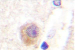 Image no. 2 for anti-Rabphilin 3A (RPH3A) antibody (ABIN272075) (RPH3A 抗体)