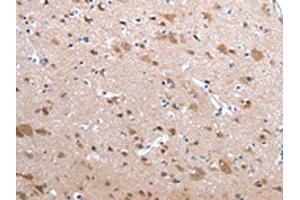 The image on the left is immunohistochemistry of paraffin-embedded Human brain tissue using ABIN7190229(CFC1 Antibody) at dilution 1/20, on the right is treated with synthetic peptide. (CFC1 抗体)