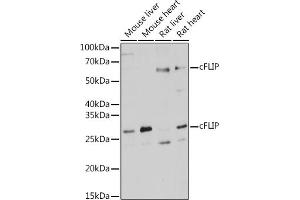 Western blot analysis of extracts of various cell lines, using cFLIP antibody (ABIN3016246, ABIN3016247, ABIN3016248 and ABIN6219655) at 1:1000 dilution. (FLIP 抗体  (AA 161-480))
