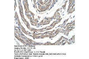 Rabbit Anti-STK11 Antibody  Paraffin Embedded Tissue: Human Muscle Cellular Data: Skeletal muscle cells Antibody Concentration: 4. (LKB1 抗体  (N-Term))