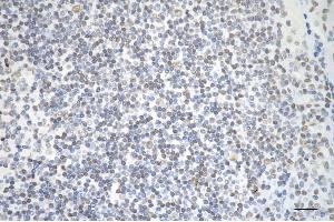 Immunohistochemistry was performed on paraffin-embedded human tonsillitis using AKAP8 antibody (ABIN7797435), 1:200). (AKAP8 抗体)