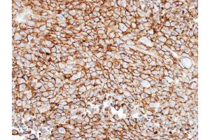 IHC-P Image Immunohistochemical analysis of paraffin-embedded H1299 xenograft, using GRK3, antibody at 1:100 dilution. (ADRBK2 抗体  (N-Term))