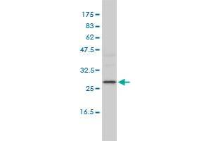 DEPC-1 monoclonal antibody (M01), clone 2A5-4F5 Western Blot analysis of DEPC-1 expression in K-562 . (ALKBH3 抗体  (AA 1-139))