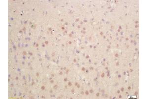 Formalin-fixed and paraffin embedded rat brain labeled with Anti-HES1 Polyclonal Antibody, Unconjugated  at 1:200 followed by conjugation to the secondary antibody and DAB staining (HES1 抗体  (AA 41-150))
