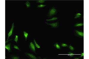 Immunofluorescence (IF) image for anti-Cystathionine-beta-Synthase (CBS) (AA 1-100) antibody (ABIN514086)