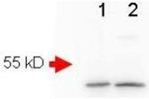 Image no. 3 for anti-Amyloid beta (Abeta) (AA 1-14), (N-Term) antibody (ABIN401205) (beta Amyloid 抗体  (N-Term))