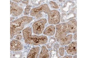 ABIN6266785 at 1/100 staining human kidney tissue sections by IHC-P. (TUBGCP3 抗体  (N-Term))