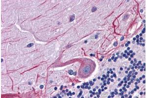 Human Brain, Cerebellum: Formalin-Fixed, Paraffin-Embedded (FFPE) (SKA1 抗体  (C-Term))