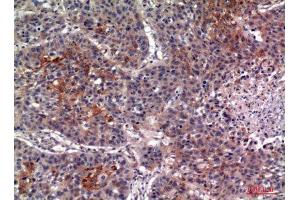 Immunohistochemistry (IHC) analysis of paraffin-embedded Human Lung, antibody was diluted at 1:100.