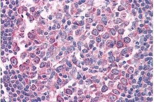 ABIN571054 (µg/ml) staining of paraffin embedded Human Tonsil. (FAS 抗体  (Internal Region))