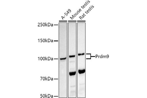 PRDM9 anticorps