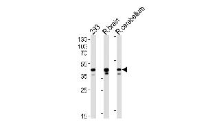 Rat Csnk2a1 Antibody (N-term) (ABIN1881717 and ABIN2843635) western blot analysis in 293 cell line , rat brain and cerebellum tissue lysates (35 μg/lane). (CSNK2A1/CK II alpha 抗体  (N-Term))