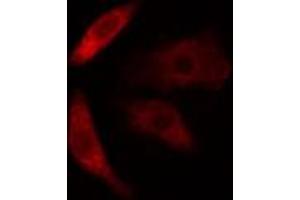 ABIN6274618 staining COLO205 cells by IF/ICC.
