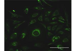 Immunofluorescence (IF) image for anti-Glutathione S-Transferase kappa 1 (GSTK1) (AA 1-226) antibody (ABIN531698)