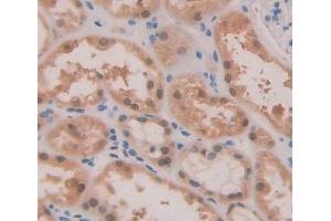 Used in DAB staining on fromalin fixed paraffin- embedded kidney tissue (ABCA2 抗体  (AA 2201-2436))