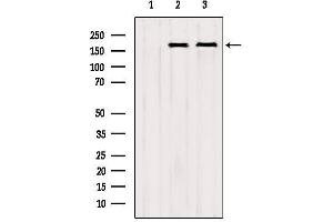 Western blot analysis of extracts from various samples, using CNOT1 Antibody. (CNOT1 抗体  (Internal Region))